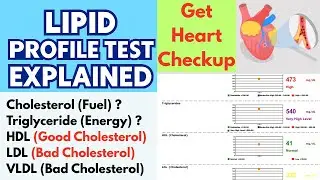 Lipid Profile Test in Urdu I Lipid profile test kya hota hai