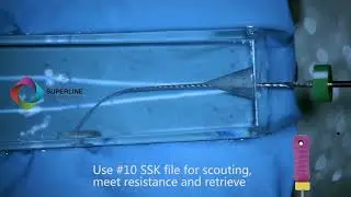 The alternative of WaveOne Gold-- W+ Rotary file systems from NIC