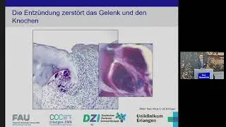 Ist es Rheuma? Pr&auml;vention, Diagnostik, Therapie bei rheumatischen Erkrankungen (Prof. Ramming)