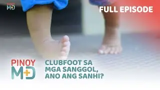 Clubfoot sa mga sanggol, ano ang sanhi? (Full Episode) | Pinoy MD