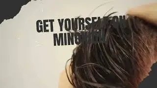 Hair Loss - The Only Two FDA Approved Treatments To Prevent Hair Loss