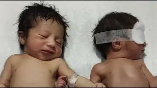 Newborn Baby live  care gentle man daily routine checkup and ubdate