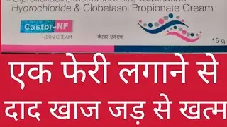 Castor NF Skin Cream | Castor NF | Castor NF Cream uses in hindi | Castor NF Cream se kya hota hai |