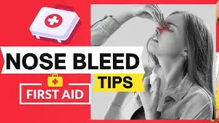 A Nose Bleed at the Mall? 🩸 Here&rsquo;s Exactly What to Do! | First Aid for Nosebleeds