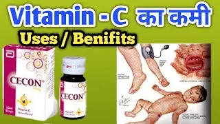 Cecon Dropes / Vitamin C Uses/ Benifits/ Dose in Hindi.