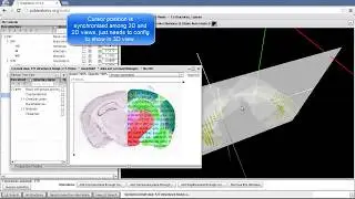 Pubanatomy 3D ---- 5 mins to see how complex web UI can get