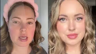 GRWM Easter Makeup 💛🩷🩵 glowy skin tutorial, acne prone & oily skin