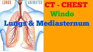 Ct Scan Chest