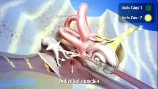 Listening therapy with the Tomatis&reg; Effect - 3D