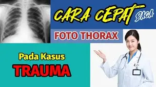 “7 MENIT” TUTORIAL SINGKAT| BACA FOTO THORAX X-RAY KASUS TRAUMA