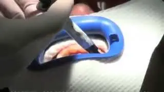 Dr Levi's - ABC - Is tooth whitening safe?