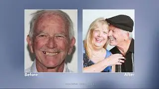 Replacing Missing Teeth with Dental Implants | Dr. Nate Farley