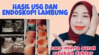 HASIL USG DAN ENDOSKOPI LAMBUNG | CARA MINTA RUJUKAN UNTUK PASIEN BPJS