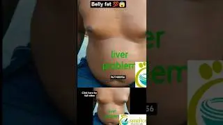 Belly fat 💯😱 #tamilshorts #viral #trending #health #bellyfat #weightloss  #naturopathy #tamil