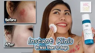 Smile Skin - MELAZERO Toner | Product Review | Instant Kinis #productreviewph #instantkinis