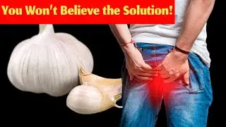Garlic Health Benefits Explained | How Garlic Boosts Immunity, Heart & More