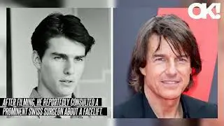 Has Tom Cruise Had Plastic Surgery? See Before and After Photos of His Striking Transformation Amid