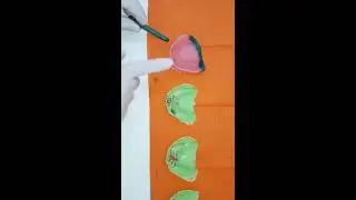 Visit 6; Correcting an  upper denture with no retention: rugae area relief and creating a post dam