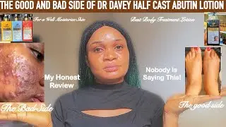 HOW TO USE DR DAVEYS HALFCAST +ALPHA ABUTIN WHITENING LOTION WITHOUT ANY SIDES EFFECTS