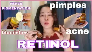 RETINOL SERUM, AND CREAM, HONEST REVIEW