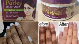Amavuta(Parley Beauty cream) yagufasha gukura amabara ku intoki ibirenge n'ahandi.