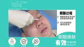 医美刷酸 从根源治疗痘痘