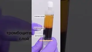 ТОП средство для РОСТА ВОЛОС. PRP-терапия (плазмотерапия) от выпадения волос