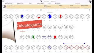 Odontograma
