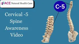Cervical 5 spine awareness video