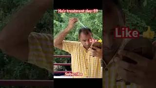 tdc advance Hair growth kit review ||day-59||