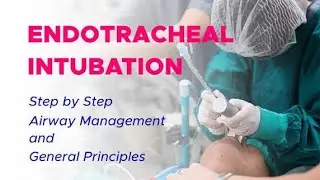 Intubation Procedure Vedio || Emergency patient care | Icu Care | Kidney Care @Dr.N. Datta 