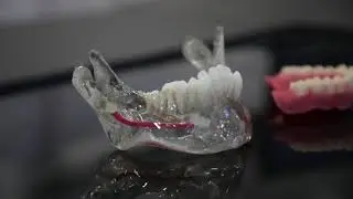 Stratasys Objet 30 Prime / ინდივიდუალ ლაინ დენტ ექსპერტ