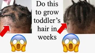 Do this to grow toddler&rsquo;s hair fast / hair growth within weeks | wlhmc allnatural