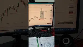Stock Market Trading | Options Trading Technical Analysis - Candlestick Pattern #stockmarket