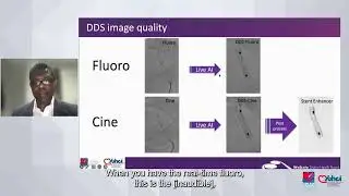 Elevate interventional cardiology procedures with AI technology - DDS & Echo Fusion