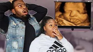 FINDING OUT WHO OUR BABY GIRL LOOKS LIKE! (4D ULTRASOUND VIDEO)