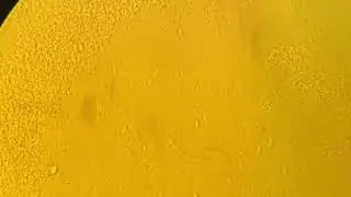 Campylobacter motility test hanging drop method