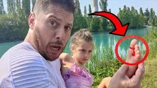 NOEMI SI TAGLIA UN PIEDE AL COMPLEANNO DI SPRIZZI !! 😱