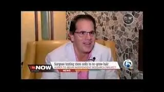 Dr. Bafitis on WPTV in West Palm Beach Talking Groundbreaking Hair Loss Treatment