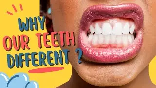 Mystery of Crooked Teeth