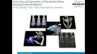 Overview and Operation of The Bruker Bone Density Software