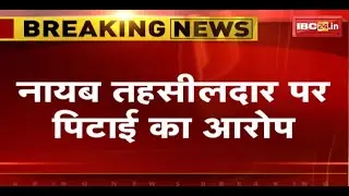 Umaria News : नायब तहसीलदार पर पिटाई का आरोप | पिटाई के बाद पीड़ित को Hospital में कराया भर्ती