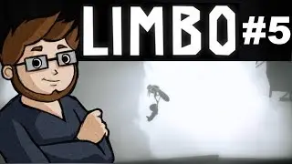 Limbo: Part 5: Leg Thief (ft. Sephazon)