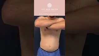 Before ➡️ After | CoolSculpting&reg; abdomen + flanks by Gina at The Skin Center