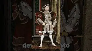 Henry VIII&rsquo;s Leg Injury: The Beginning of His Downfall