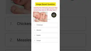 Image Based Question For Staff Nurse Exam | Image Based MCQ For Norcet #staffnurse #nursing #shorts