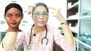 Sinusitis ke liye Best Homeopathic medicine||