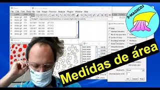 Medidas de área com ImageJ / FIJI