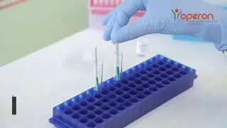 Test celiaqu&iacute;a CD1 &mdash; detecci&oacute;n de anti tTG en suero