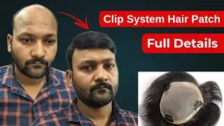 Clipping Hair Patch Review | Clipping Hair Patch For Men | Clip System Hair Patch Full Details